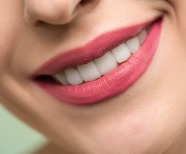 Porcelain Veneers Before And After Guide 2022