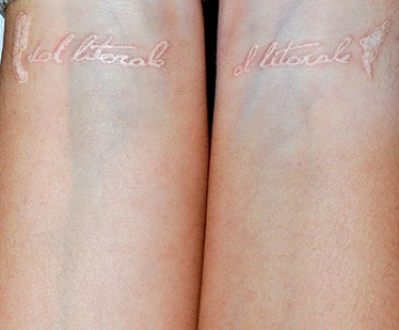 Healed White Ink Tattoo