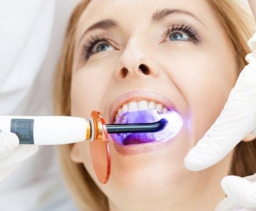 Teeth Whitening – Available Options and Safe Usage
