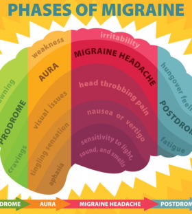 migraine cure