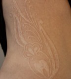 Fantastic Healed White Ink Tattoo