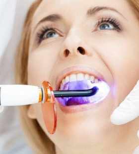 Safe teeth whitening