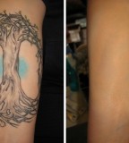 Before And After Inner Arm Tattoo Ideas
