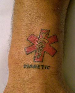 Business Of Life Medical Alert Tattoo