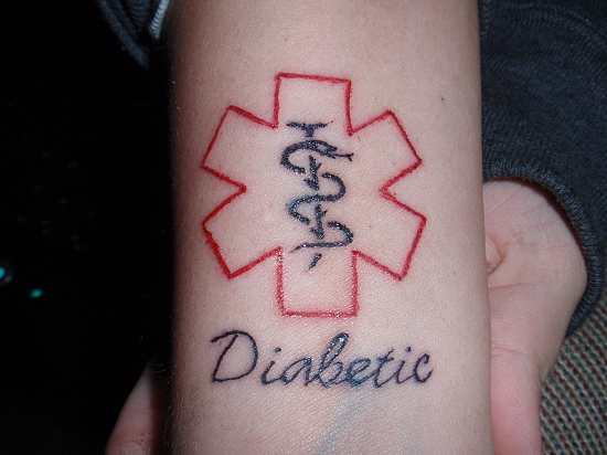 My Niece Got A Medic Alert Tattoo Today