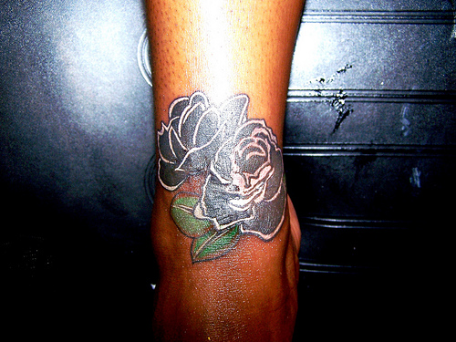 Tattoo Scar Cover Ups Ideas